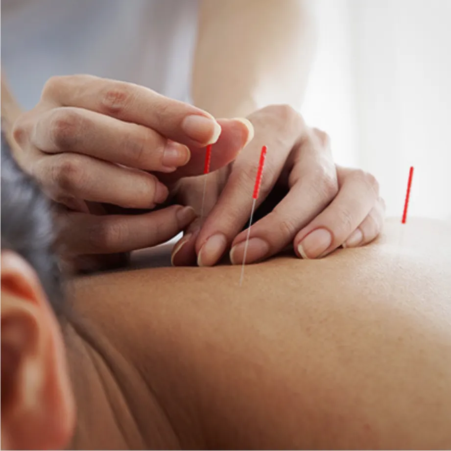Book Your FREE Physiotherapy Consultation in Solihull Today! (Deposit payment only)